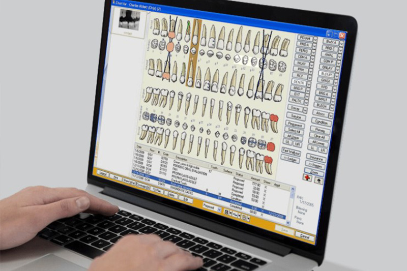 Cone Beam CT Imaging in 