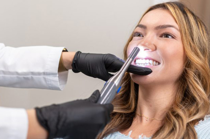 Intra-Oral Camera in 